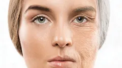 Iho nuortuu kymmeniä vuosia – luonnonlahja, joka silottaa rypyt