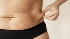 Vatsa ei lähde itsestään yli 50-vuotiaana – näin aktivoit piilevän rasvanpolttotilan