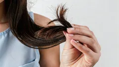 Ravitsemusterapeutit: 4 ruokailutottumusta, jotka pilaavat hiukset pysyvästi